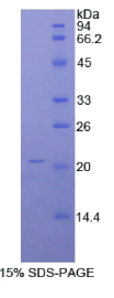 α1-酸性糖蛋白(α1AGP)重组蛋白