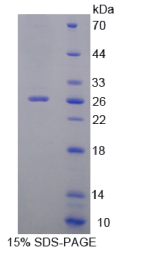 Zuotin相关因子1(ZRF1)重组蛋白