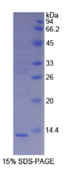 S100钙结合蛋白A4(S100A4)重组蛋白