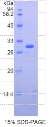 白介素2受体β(IL2Rβ)重组蛋白