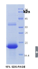 再生胰岛衍生蛋白3γ(REG3γ)重组蛋白