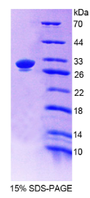 补体成分4(C4)重组蛋白