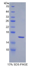 白介素18受体1(IL18R1)重组蛋白