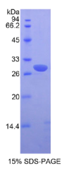 Pim-2原癌基因(PIM2)重组蛋白