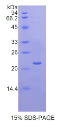 层粘连蛋白γ1(LAMγ1)重组蛋白