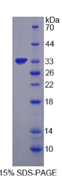 泛素蛋白连接酶E3成分N-识别蛋白4(UBR4)重组蛋白