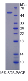 Sestrin 2蛋白(SESN2)重组蛋白