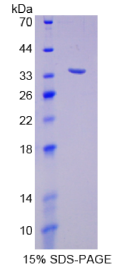 SHC-转化蛋白1(SHC1)重组蛋白