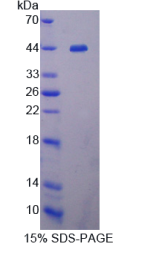 组织内转化生长因子β结合蛋白1(LTBP1)重组蛋白