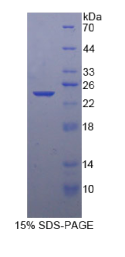 Smad同源物3(Smad3)重组蛋白