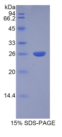 组织蛋白酶S(CTSS)重组蛋白