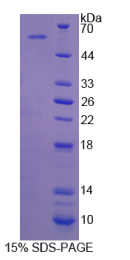 周期素依赖性激酶抑制因子3(CDKN3)重组蛋白