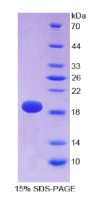 α-胞衬蛋白(SPTAN1)重组蛋白