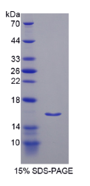 胰岛素受体底物3(IRS3)重组蛋白