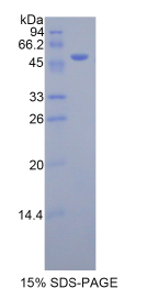 激肽释放酶7(KLK7)重组蛋白