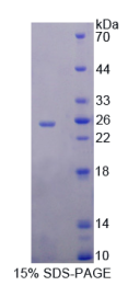 核糖核酸酶A9(RNASE9)重组蛋白