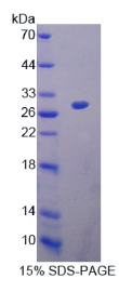 烟碱型胆碱受体α2(CHRNα2)重组蛋白