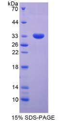 信号传导转录激活因子5B(STAT5B)重组蛋白