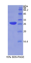 核因子κB抑制因子α(IκBα)重组蛋白