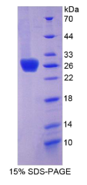 含Ⅰ型血小板域蛋白7A(THSD7A)重组蛋白
