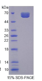 心脏肌球蛋白结合蛋白C(MYBPC3)重组蛋白