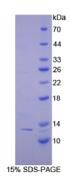 连环蛋白β相互作用蛋白1(CTNNβIP1)重组蛋白