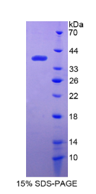 干扰素诱导蛋白35(IFI35)重组蛋白