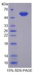 膜联蛋白A11(ANXA11)重组蛋白