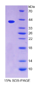 趋化因子C-C-基元配体4样蛋白1(CCL4L1)重组蛋白