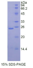 桥粒芯胶粘蛋白1(DSC1)重组蛋白