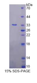 微管关联蛋白RP/EB家族成员1(MAPRE1)重组蛋白