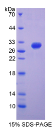 整合素β5(ITGβ5)重组蛋白