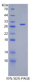 凸素1(PROM1)重组蛋白
