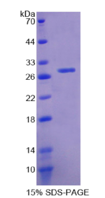 谷胱甘肽S转移酶θ2(GSTθ2)重组蛋白