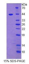 血小板反应蛋白解整合素金属肽酶5(ADAMTS5)重组蛋白