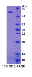 激肽释放酶1(KLK1)重组蛋白