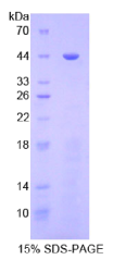 高尔基蛋白73(GP73)重组蛋白