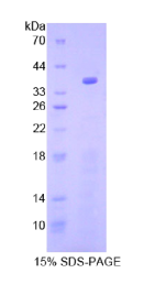 糖原合酶激酶3α(GSK3α)重组蛋白