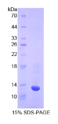 胱天蛋白酶6(CASP6)重组蛋白