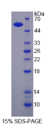 整合素β6(ITGβ6)重组蛋白