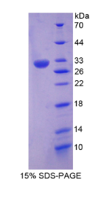 含RNA结合冷休克域蛋白E1(CSDE1)重组蛋白
