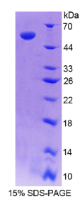 维甲酸受体应答基因1(RARRES1)重组蛋白