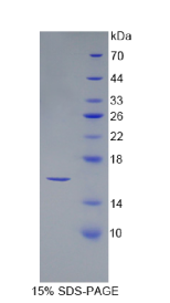 分泌型卷曲相关蛋白5(SFRP5)重组蛋白