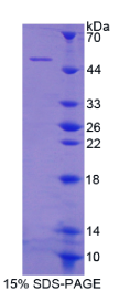 细胞附着蛋白1(CYTH1)重组蛋白