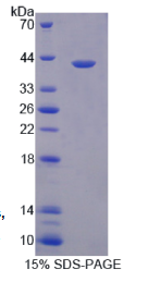 抗原肽转运蛋白1(TAP1)重组蛋白