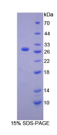 钙非依赖性磷脂酶A2(iPLA2)重组蛋白