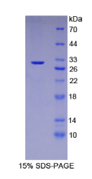 结蛋白(Des)重组蛋白