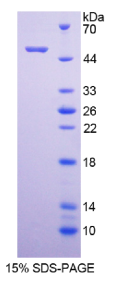血小板亲和蛋白1(PKP1)重组蛋白