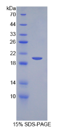 干细胞因子(SCF)重组蛋白