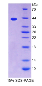 原肌球蛋白2β(TPM2)重组蛋白